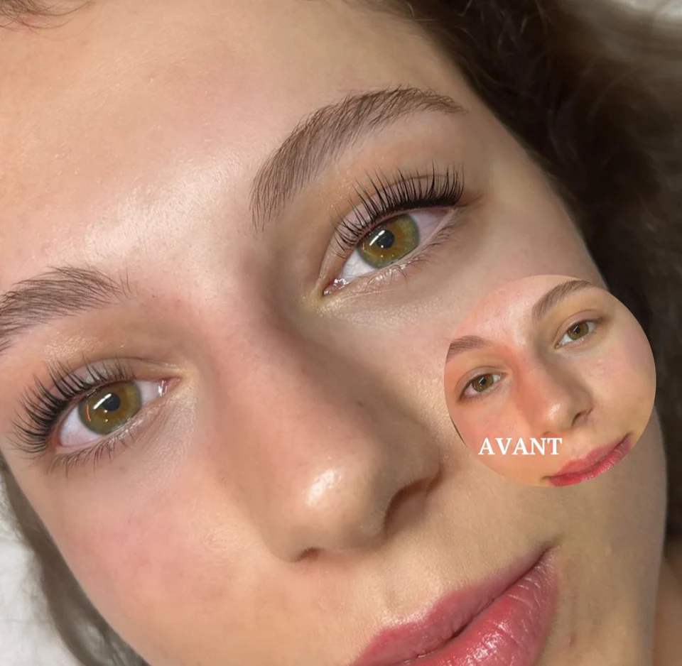 Lash lift fast